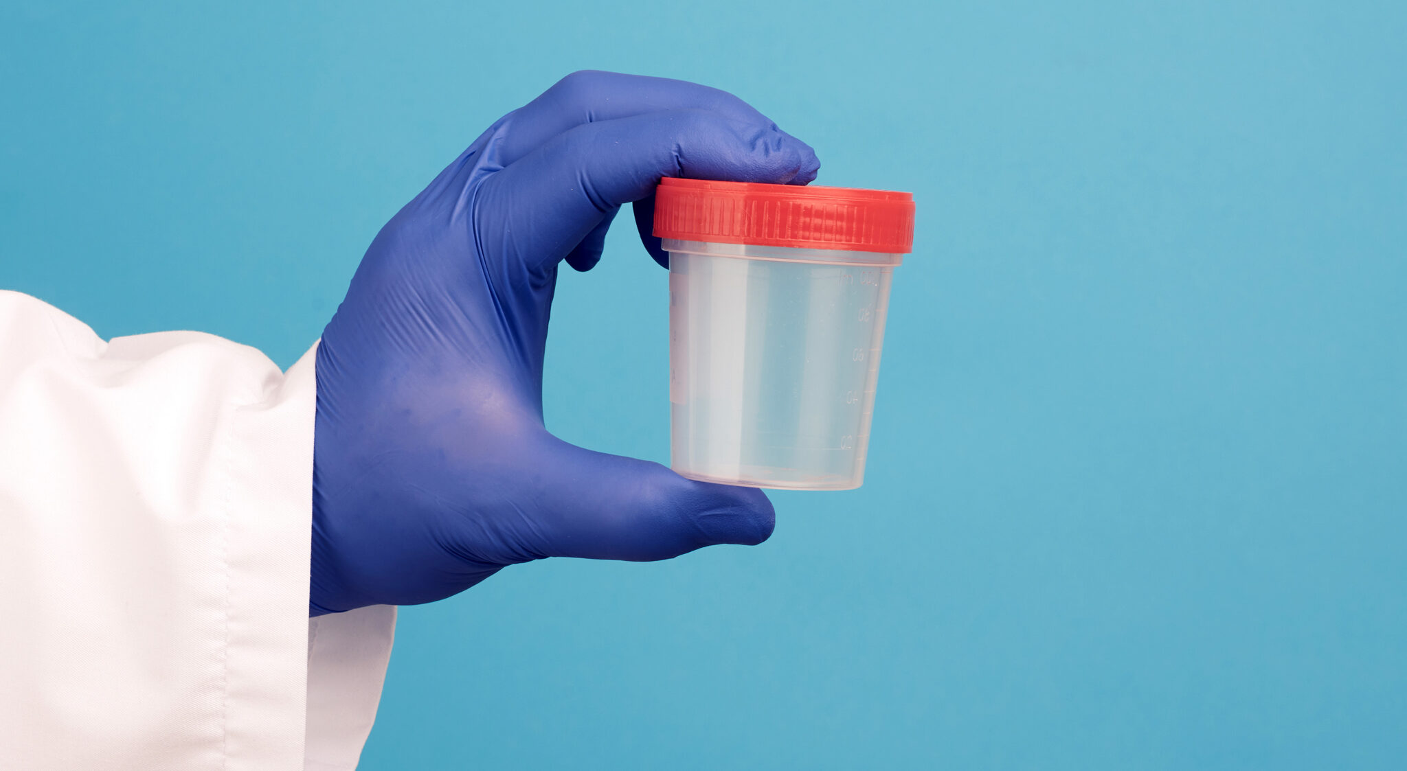 the-pros-and-cons-of-workplace-drug-testing-groupone-services